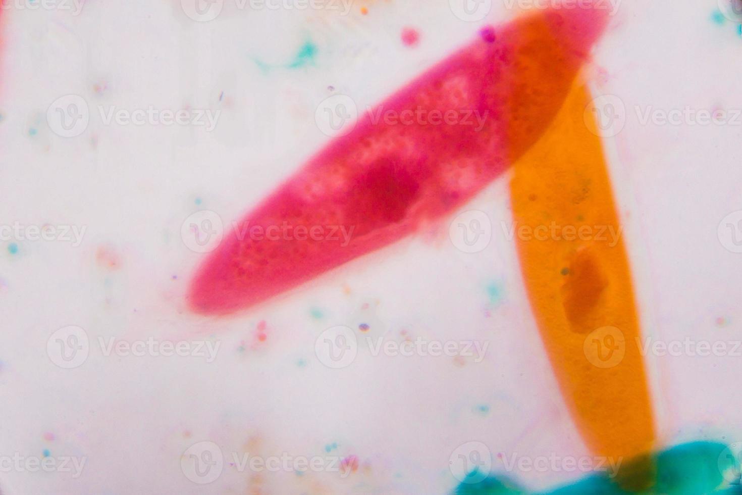 Paramecium caudatum bajo el microscopio: formas abstractas en color verde, rojo, naranja y marrón sobre fondo blanco. foto