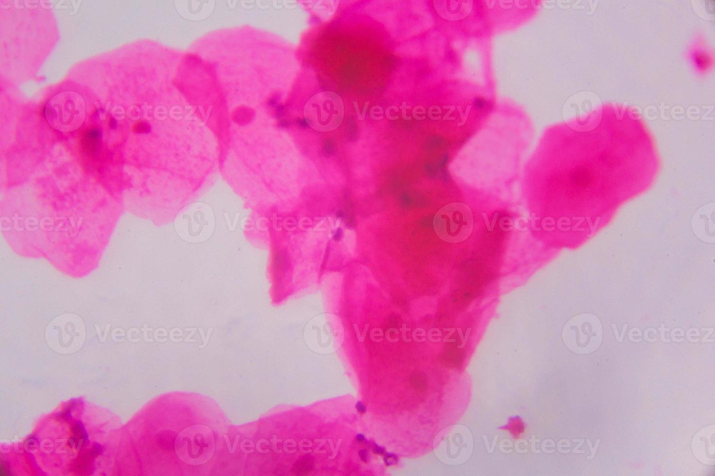 Multiple squamous epithelium under the microscope - Abstract pink dots on white background photo