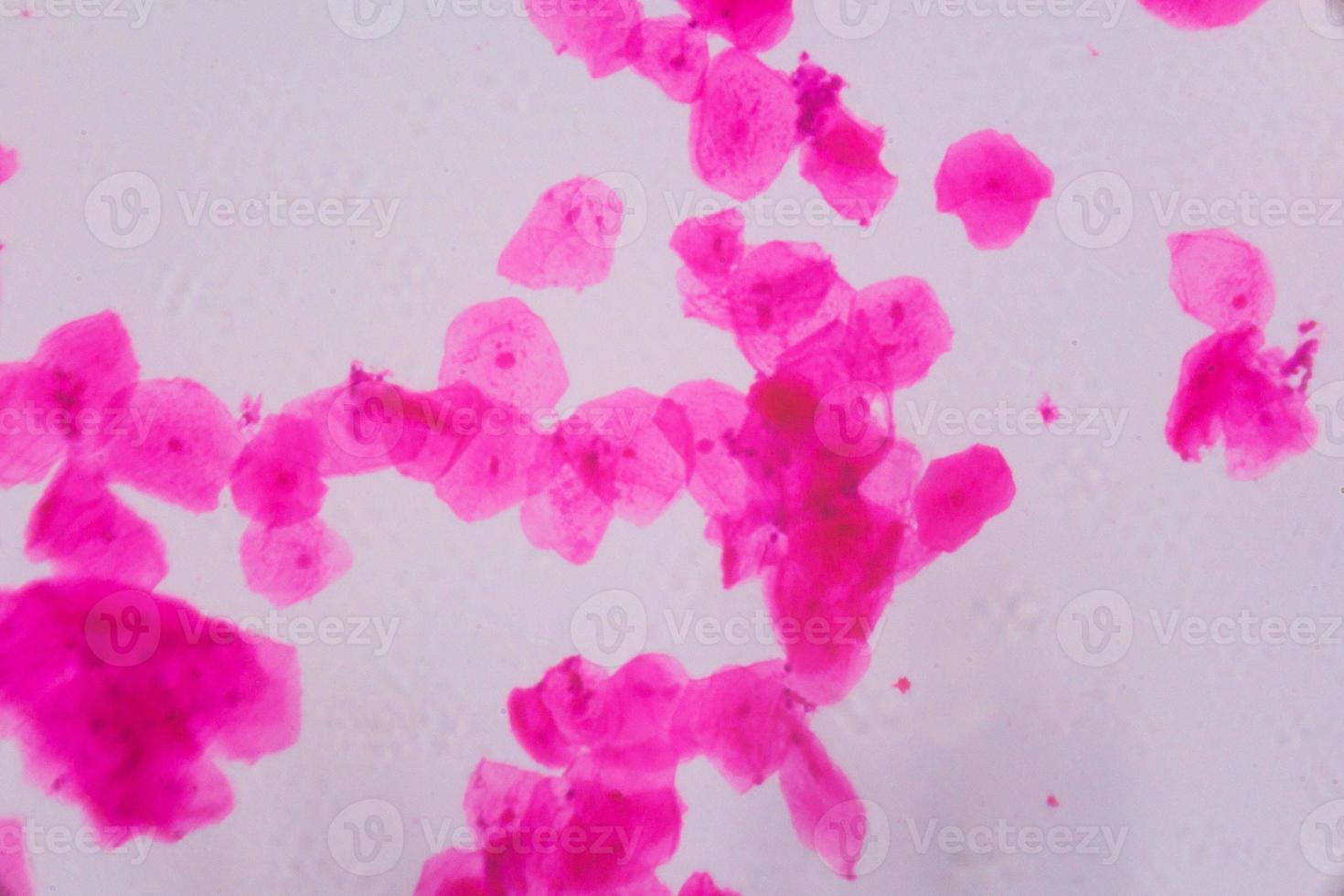 Multiple squamous epithelium under the microscope - Abstract pink dots on white background photo