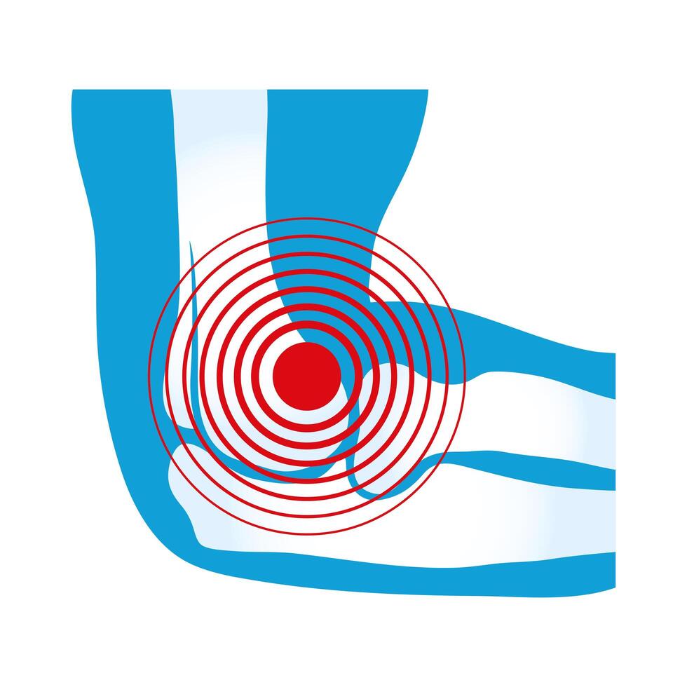 elbow rheumatological pain vector