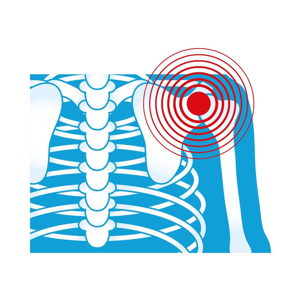 shoulder rheumatological pain vector