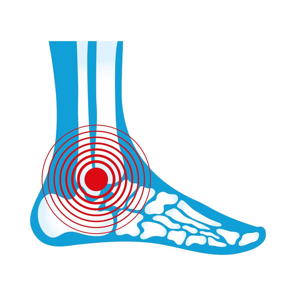 ankle rheumatological pain vector