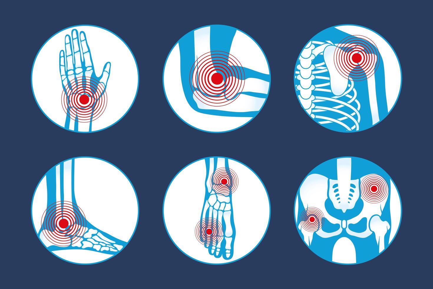 seis iconos de reumatología vector