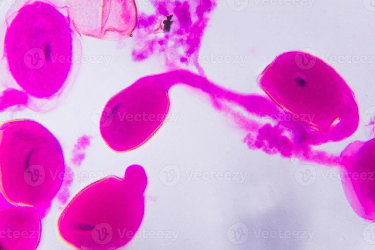 Hemerocallis citrina mature anther under the microscope - Abstract pink dots on white background photo