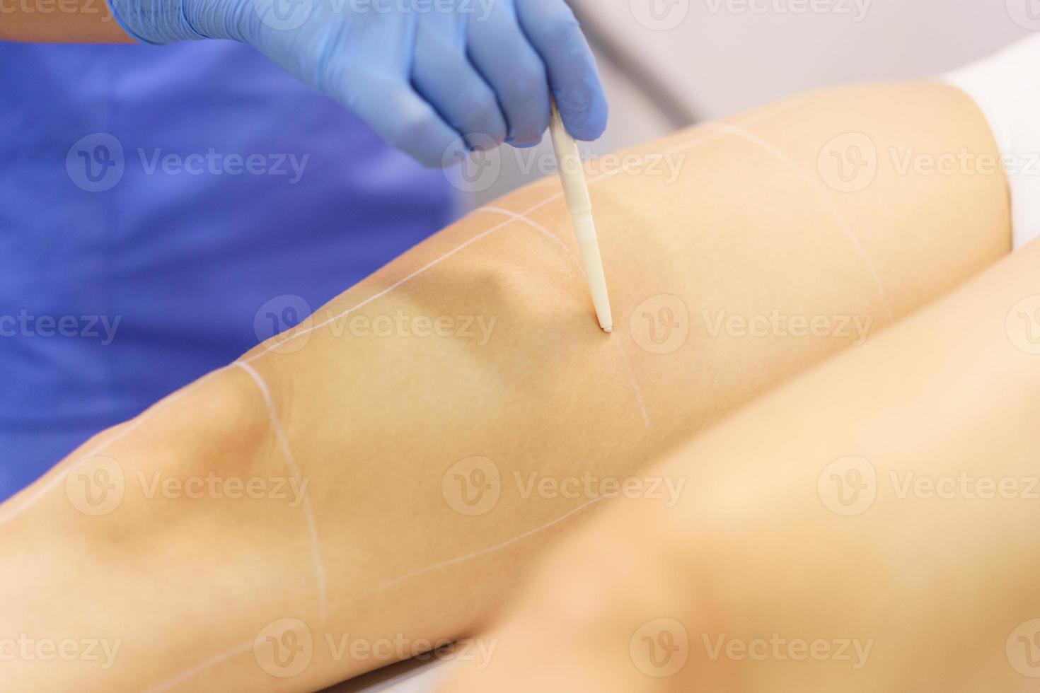 Woman receiving legs laser hair removal at a beauty center. photo