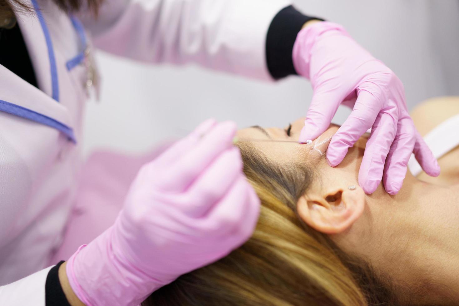 médico inyectando hilos de tratamiento de sutura pdo en el rostro de una mujer. foto