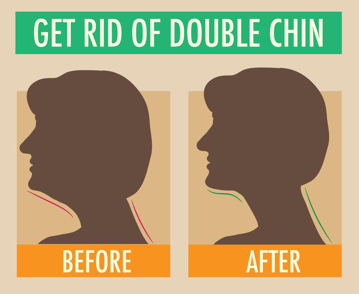 Reduce double chin. Get rid of face and neck fat concept. vector