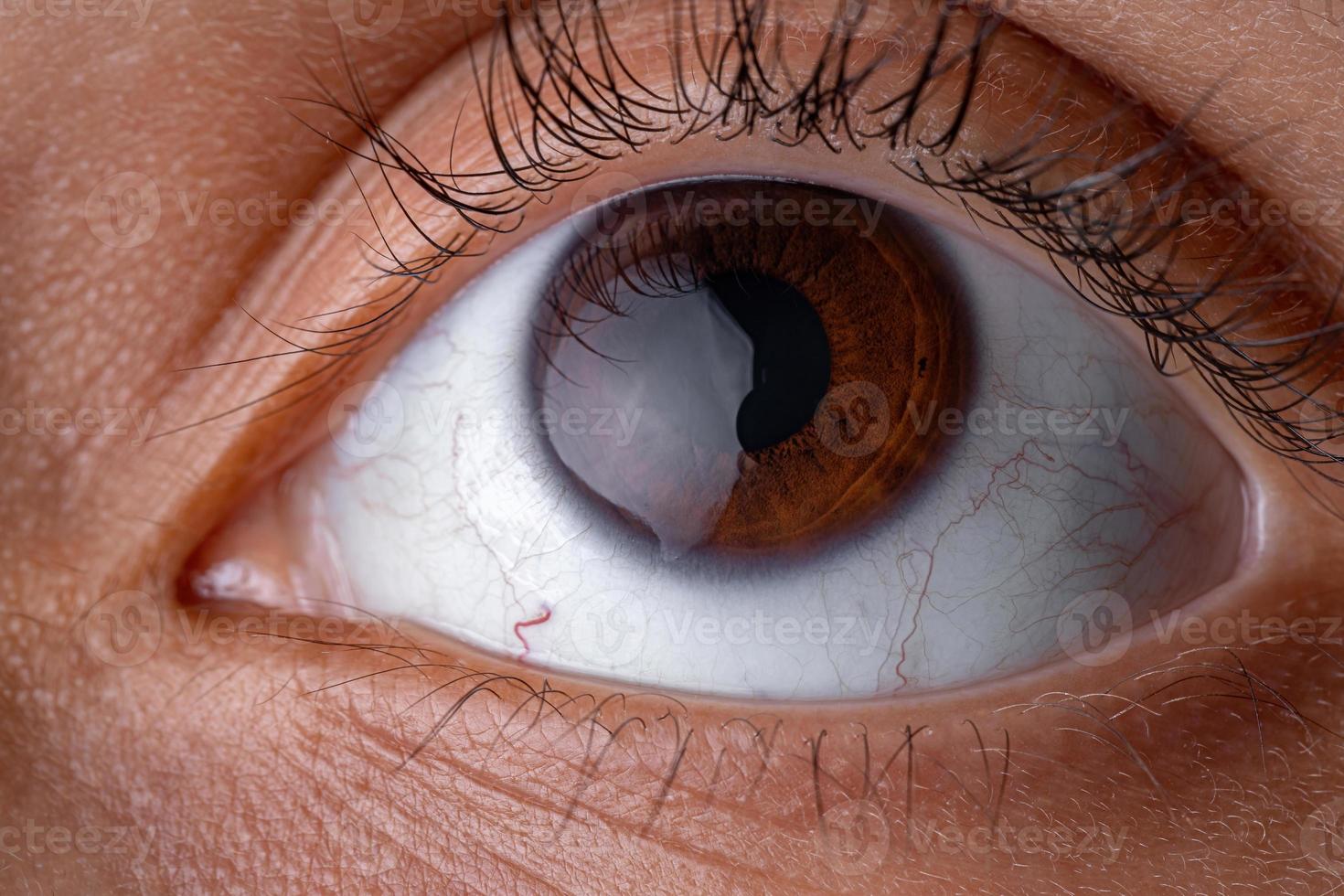 brown human eye photo