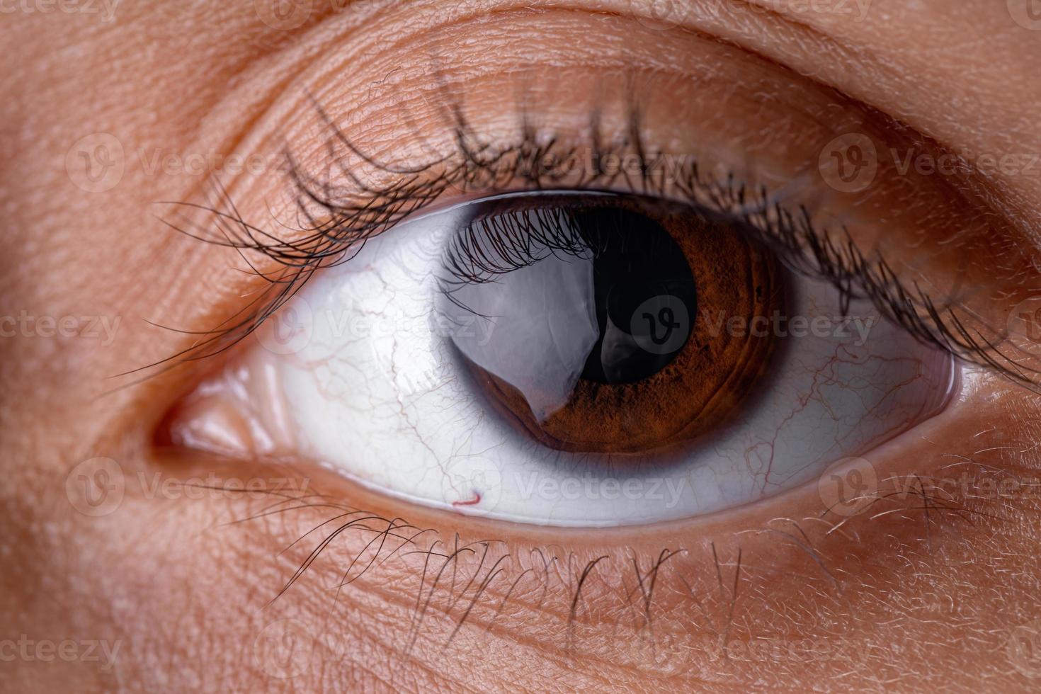 Brown human eye photo