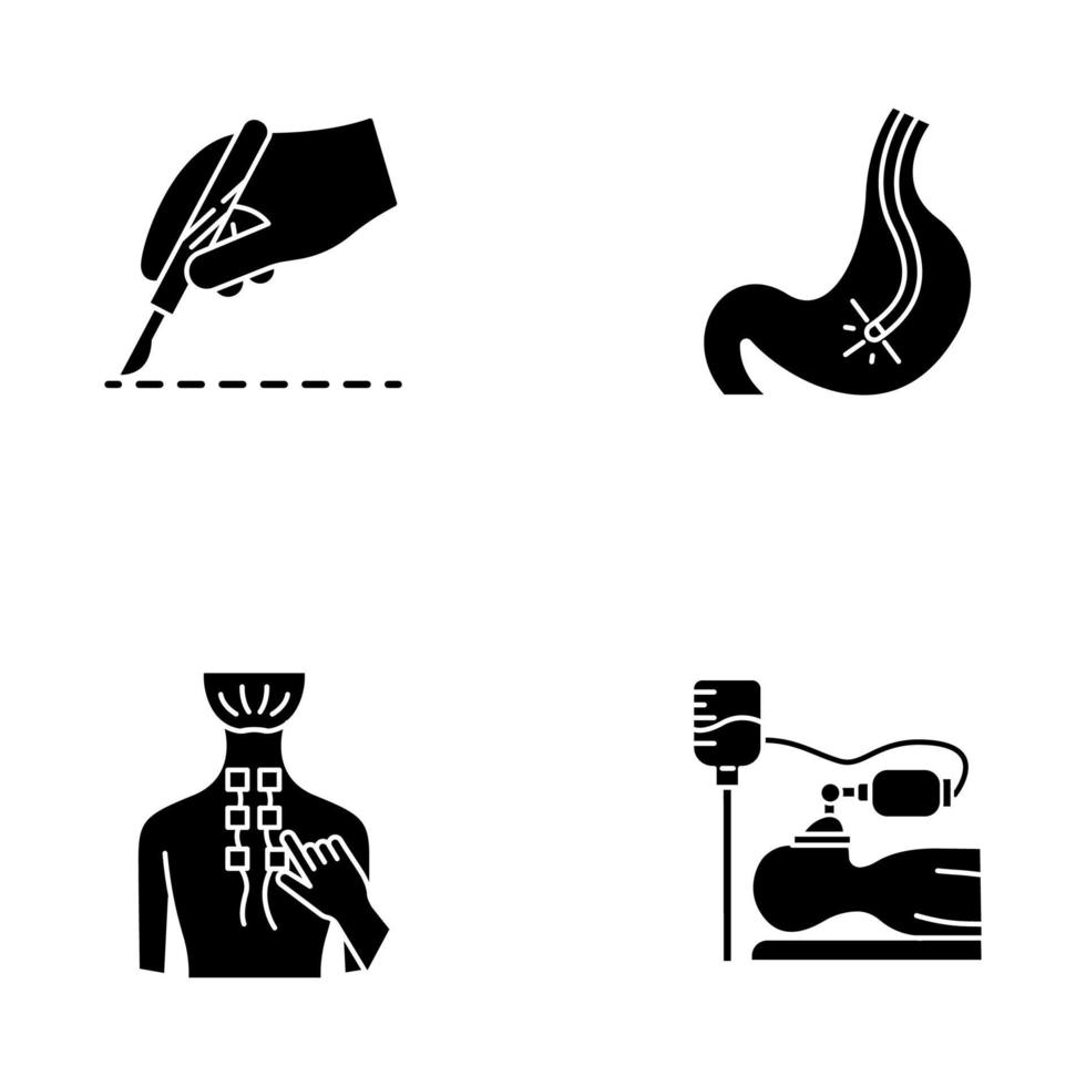 conjunto de iconos de glifo de procedimiento médico. cirugía. endoscopia y gastroscopia. tracto digestivo, chequeo de estómago. fisioterapia. alivio del dolor de espalda. anestesia. símbolos de silueta. vector ilustración aislada