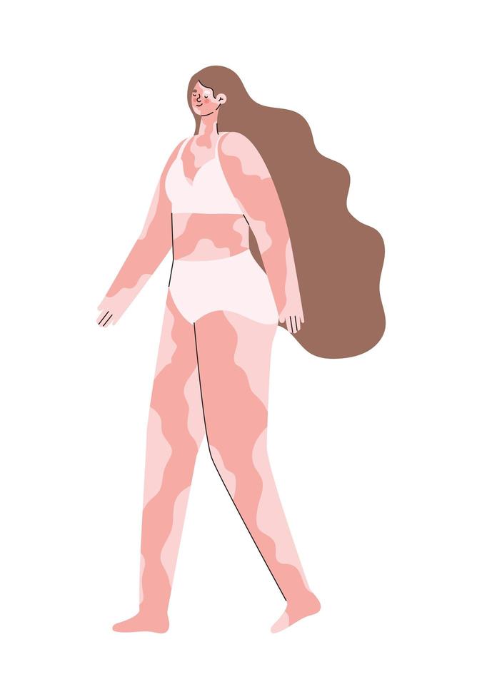 woman with vitiligo in underwear vector