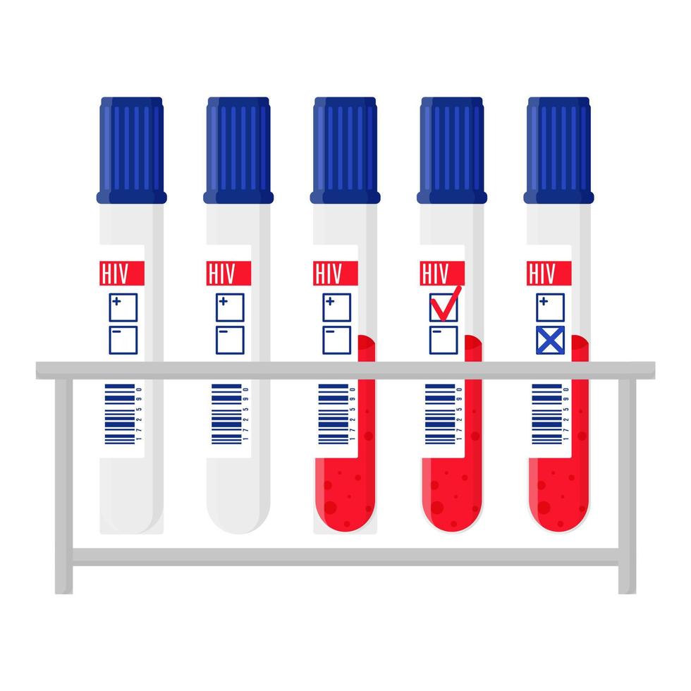 Vector stand and test tubes with blood test for HIV.