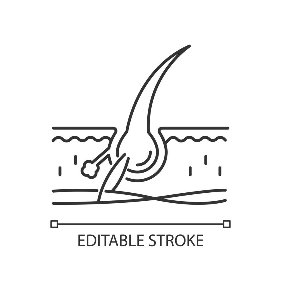 Follicle pixel perfect linear icon. Damaged hair root. Microscopic look on skin tissue. Thin line customizable illustration. Contour symbol. Vector isolated outline drawing. Editable stroke