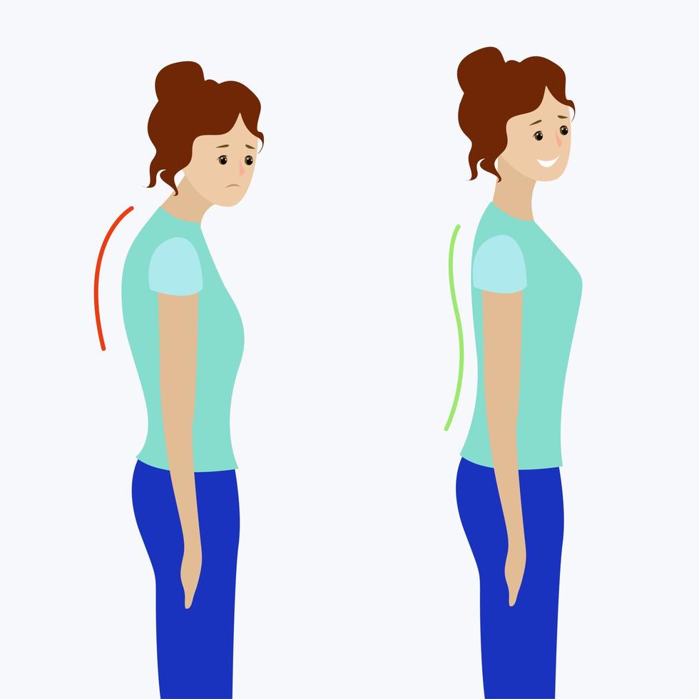 Two girls with a straight and curved spine vector