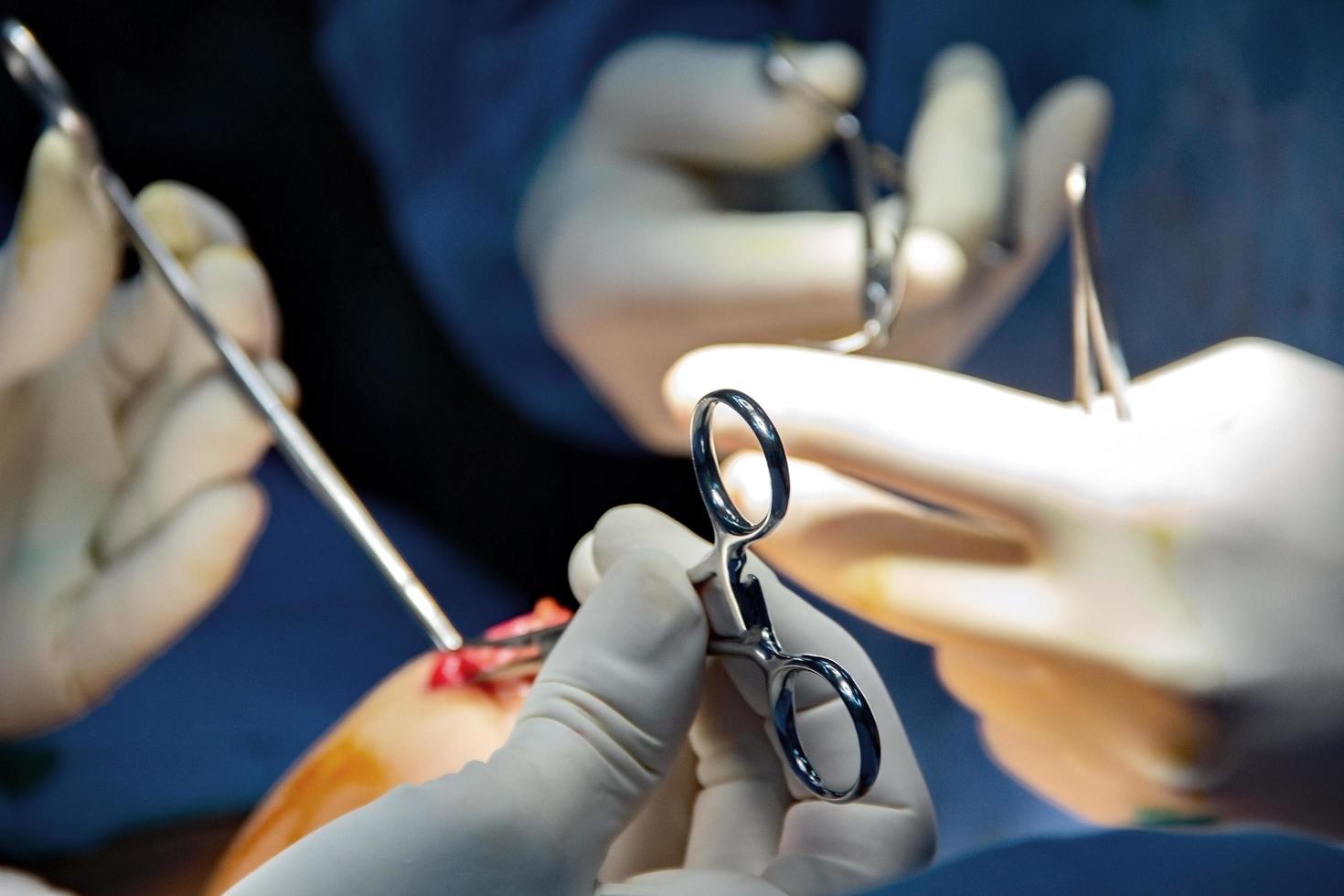 Open breast surgery. Close-up of the breast and the hands and tools of the doctors. photo