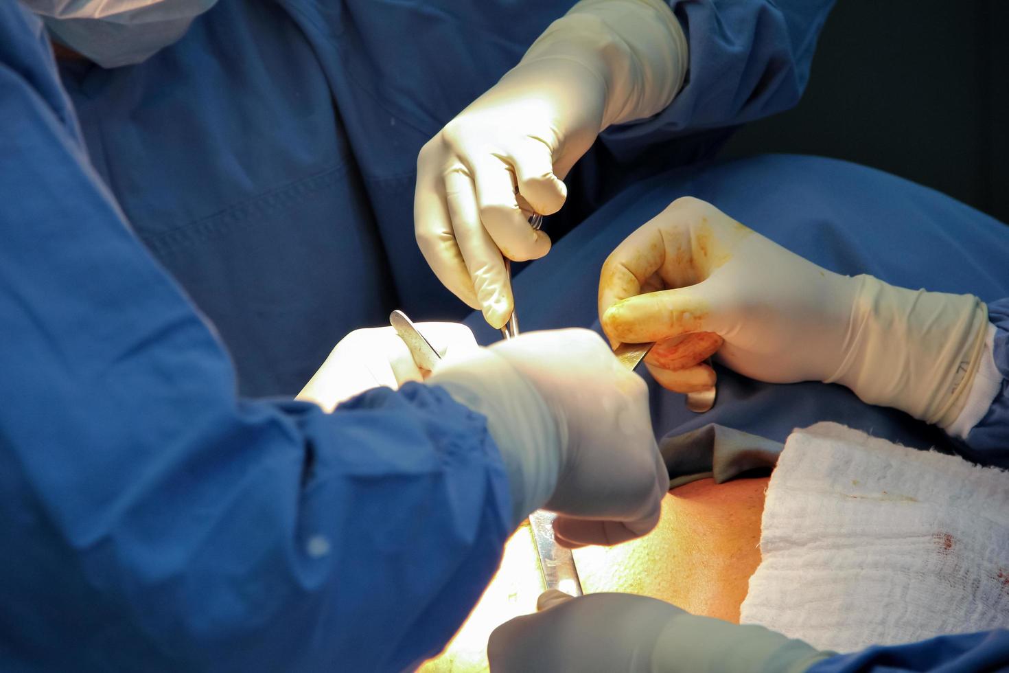 Close-up of the hands of surgeons operating a patient. photo