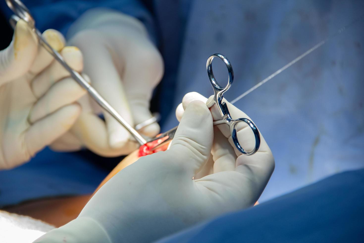 equipo médico de cirujanos en una clínica de cirugía plástica. Cirugía de implantes mamarios. foto