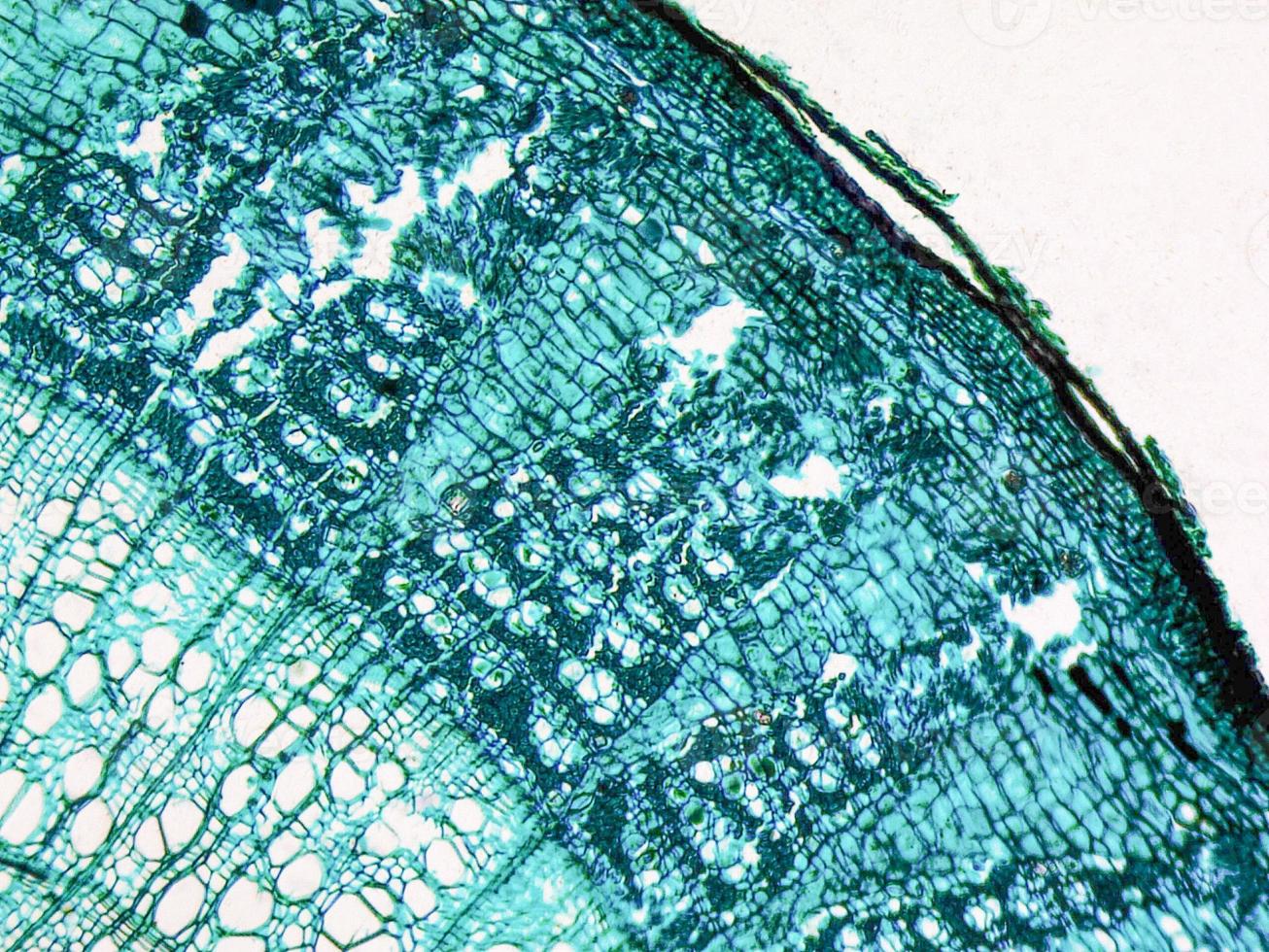 Tilia stem micrograph photo