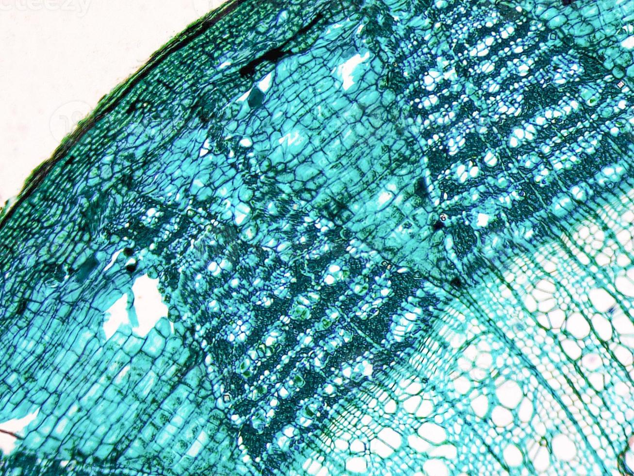Tilia stem micrograph photo