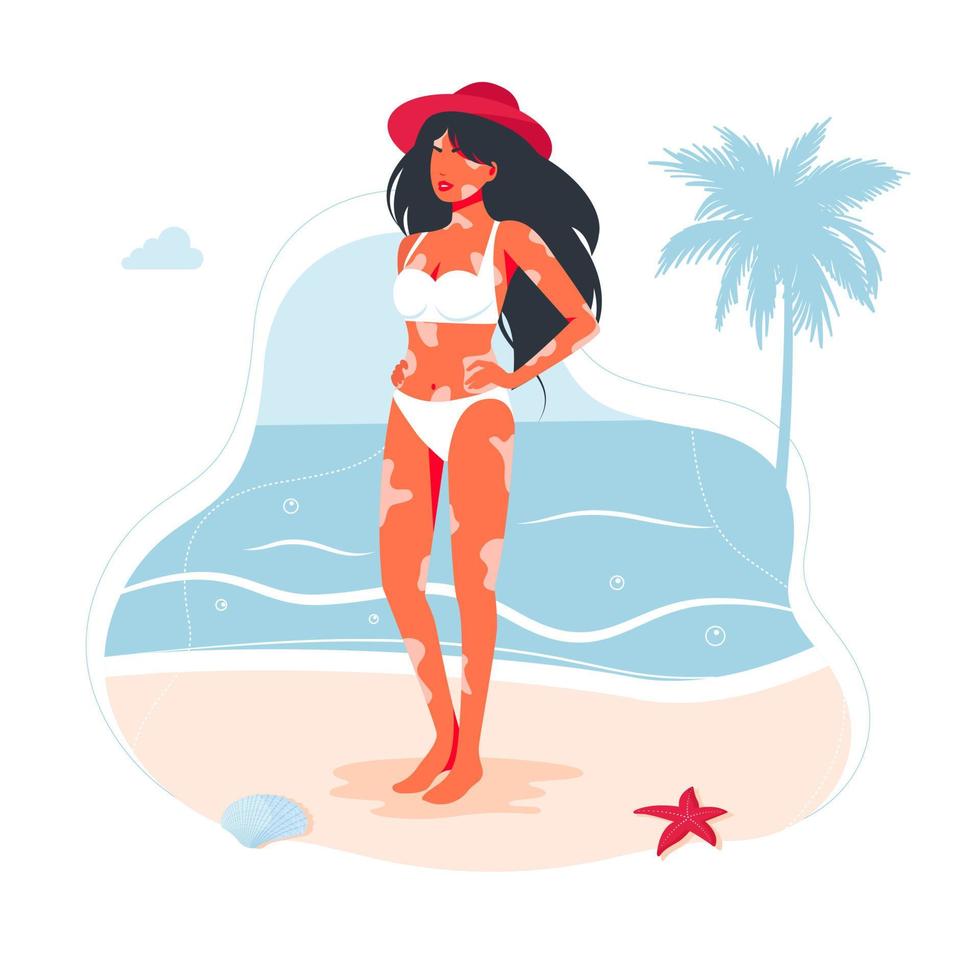 enfermedad de la piel por vitiligo en una niña en traje de baño y sombrero. una mujer diagnosticada de vitiligo no duda en tomar el sol en la playa. el concepto de belleza diferente, corporalmente positiva, autoaceptación. vector