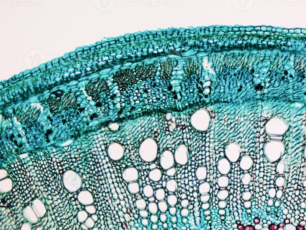 Cotton stem micrograph photo