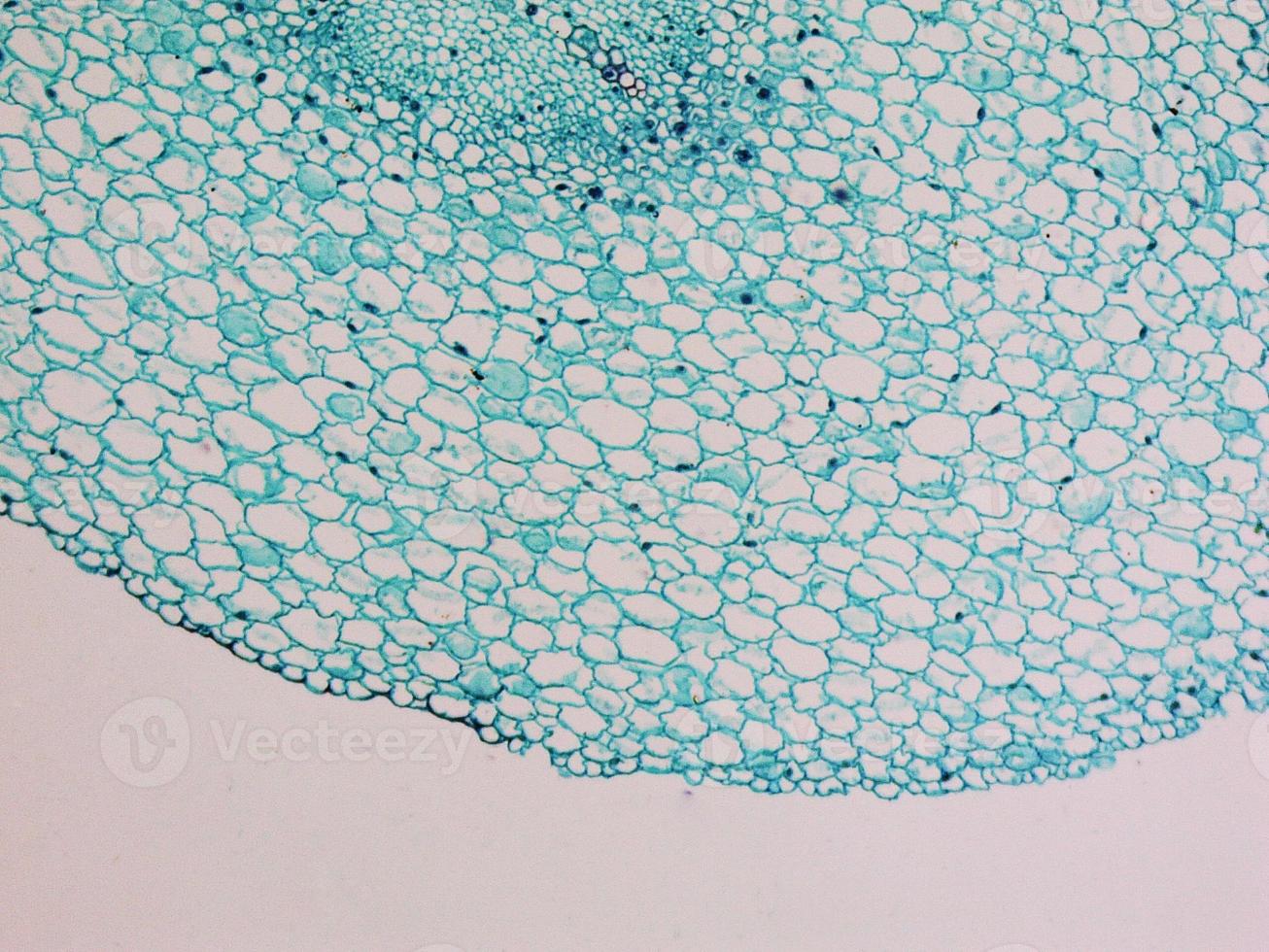 Vicia faba root micrograph photo