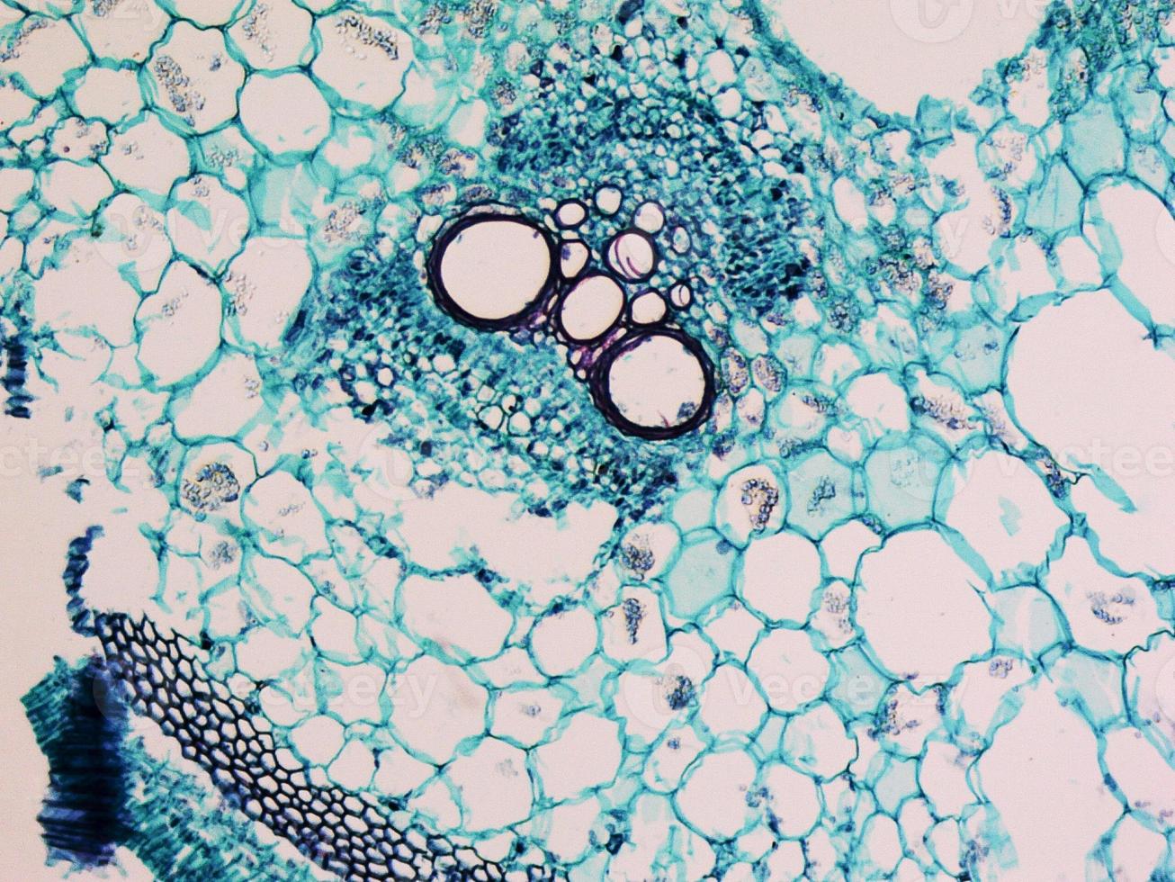 Cucurbita stem micrograph photo