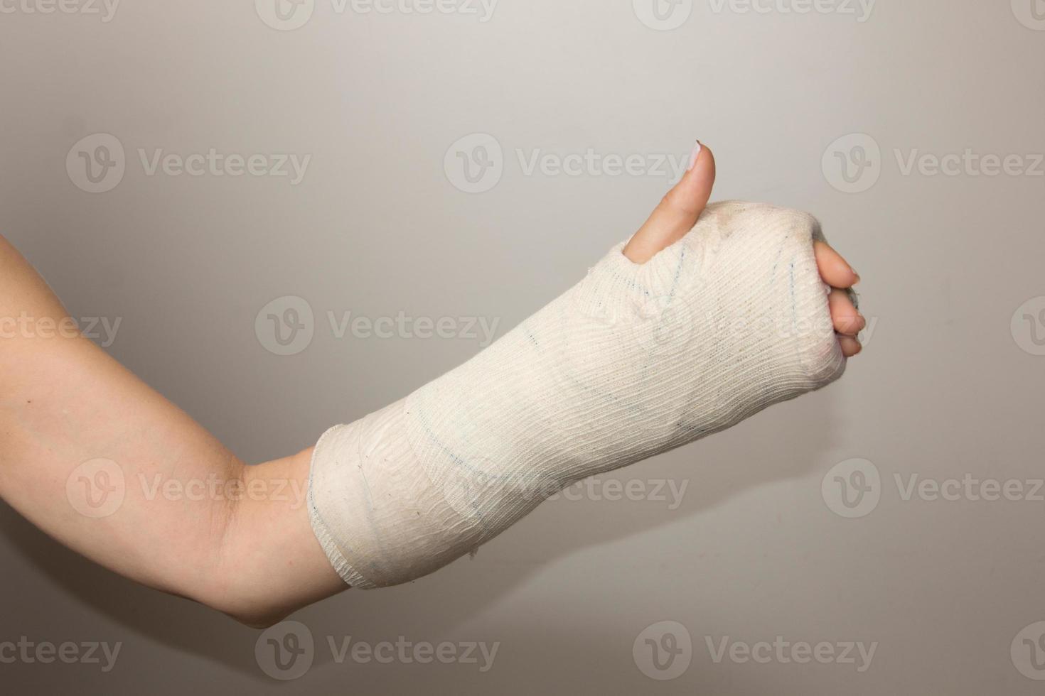 Lady with a Broken Hand and Wrist wrapped in a cast photo