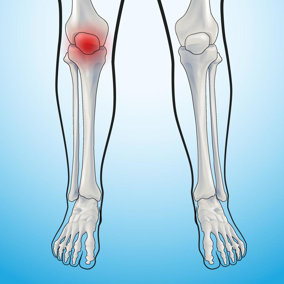 Ilustración médica educativa de los huesos de las piernas. vector