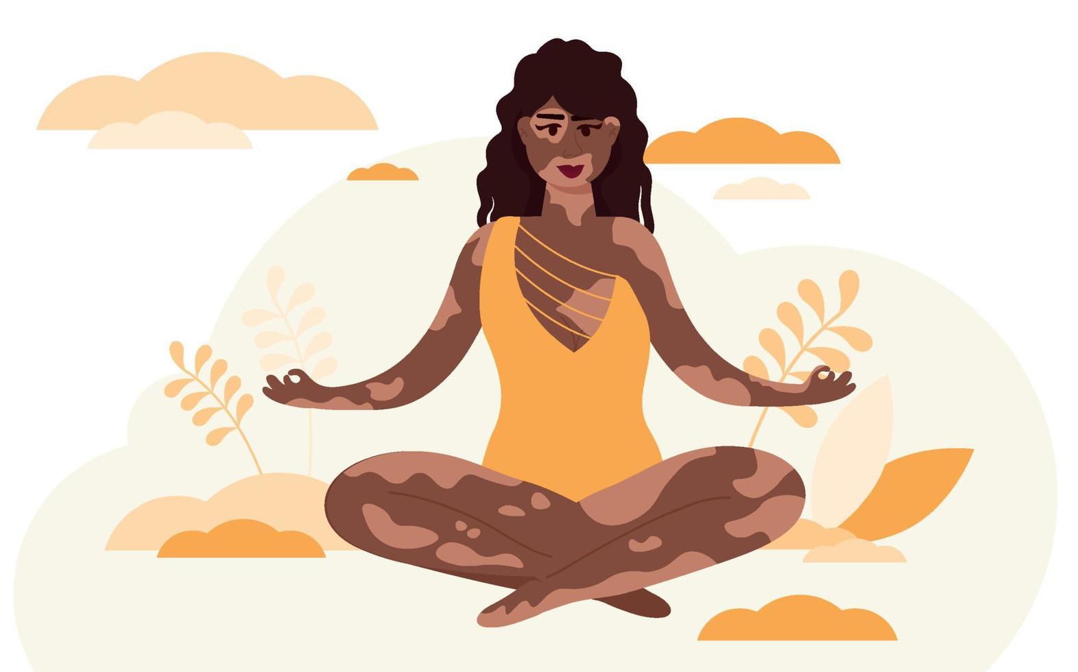 Vector illustration of a beautiful woman with a Vitiligo.Love yourself.Body positive. Vector illustration