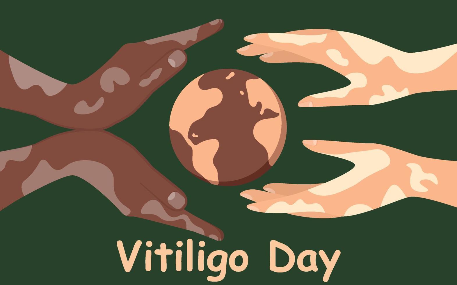 World Vitiligo Day poster. Hands of different nationalities with skin diseases. Depigmentation problem. Spotted loss of color in the dermis. Human solidarity. Vector illustration