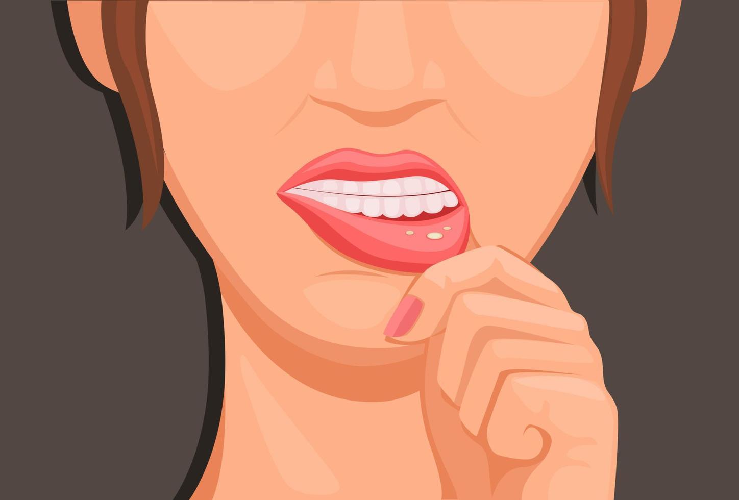 las mujeres se tocan los labios, síntomas de estomatitis. vector de dibujos animados de ilustración de símbolo médico de salud