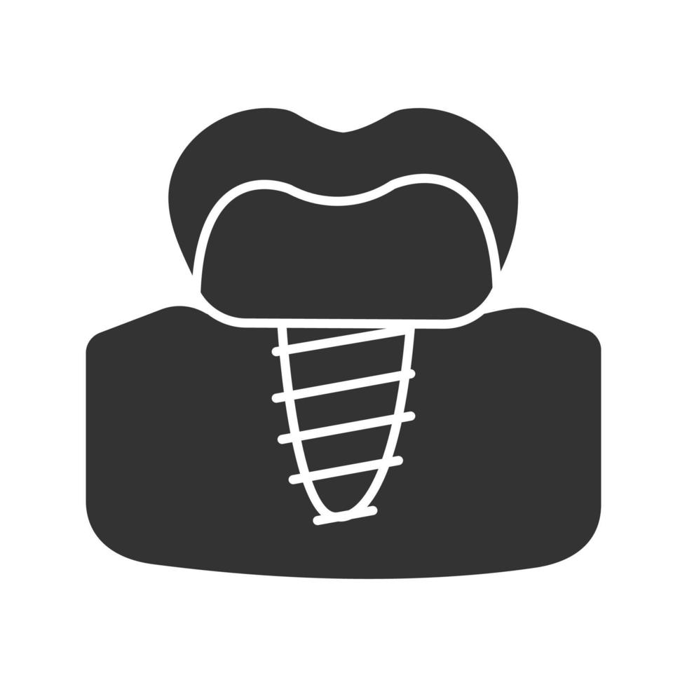 Dental implant glyph icon. Endosseous implant. Silhouette symbol. Negative space. Vector isolated illustration