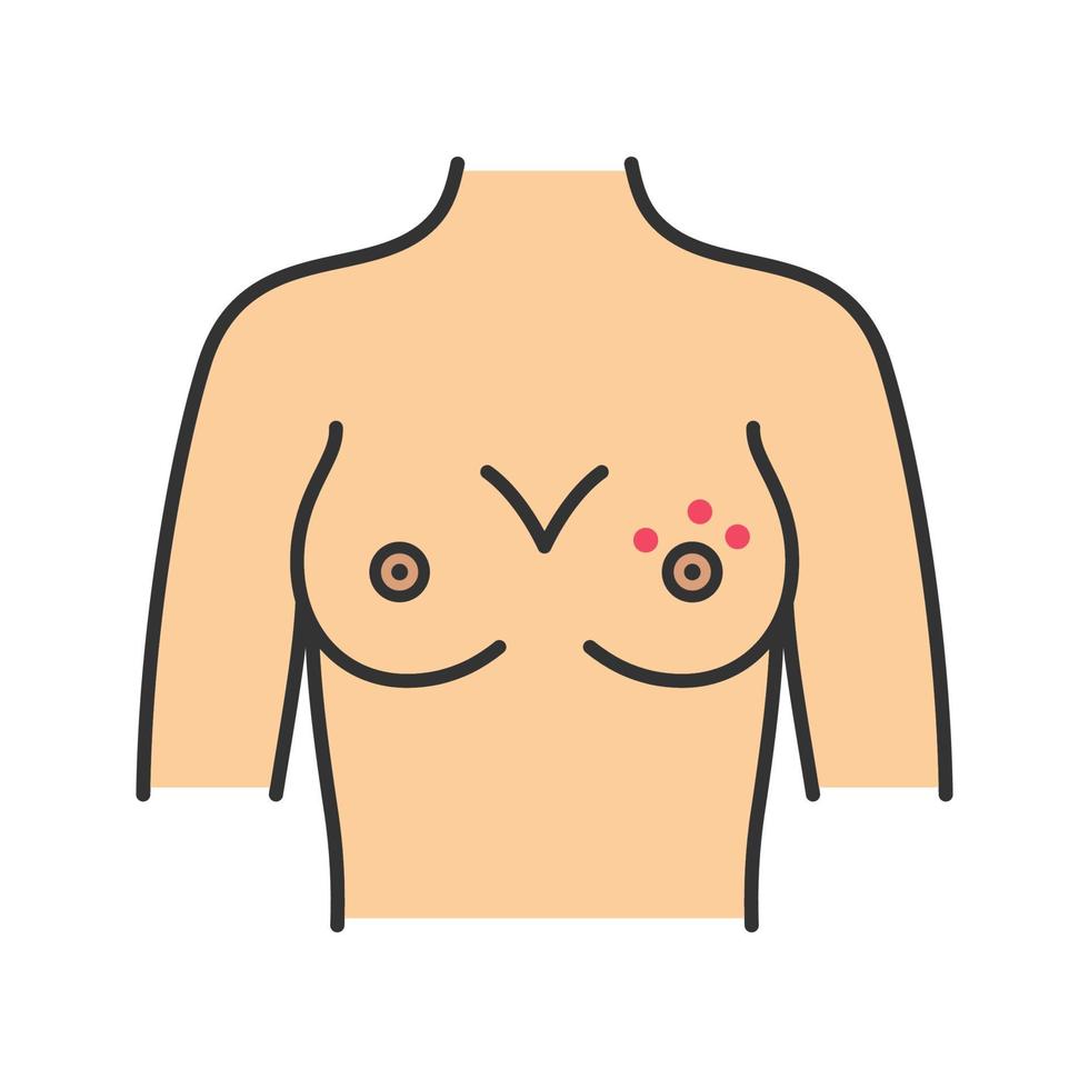 Breast rash color icon. Skin irritation or dimpling. Nipple dermatitis, abscess, dry skin. Breast cancer symptom. Isolated vector illustration