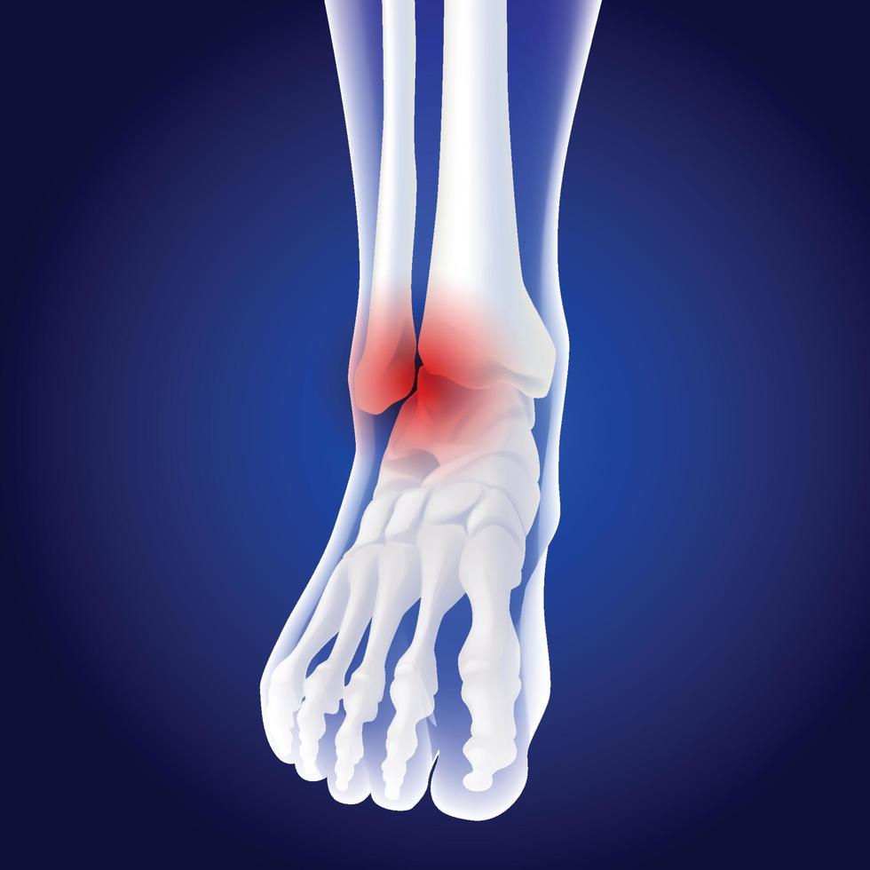 Ilustración médica educativa de los huesos del pie. vector