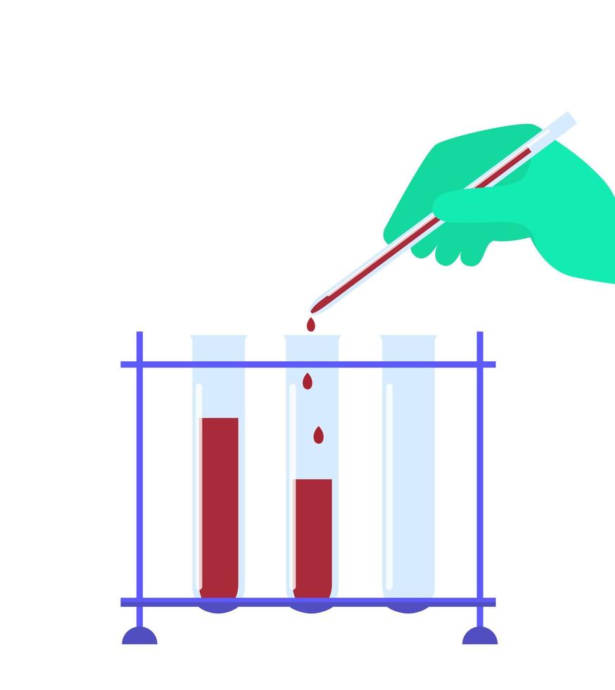 Taking blood test vector illustration. Test tubes with biomaterial. Know your HIV status. AIDS awareness.