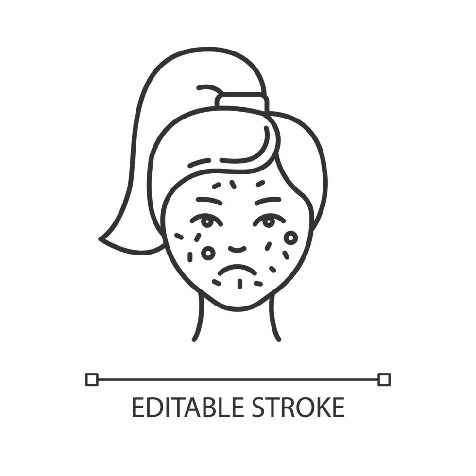 Acne linear icon. Pimples on female face. Skincare for inflammation. Cosmetology and dermatology. Thin line illustration. Contour symbol. Vector isolated outline drawing. Editable stroke