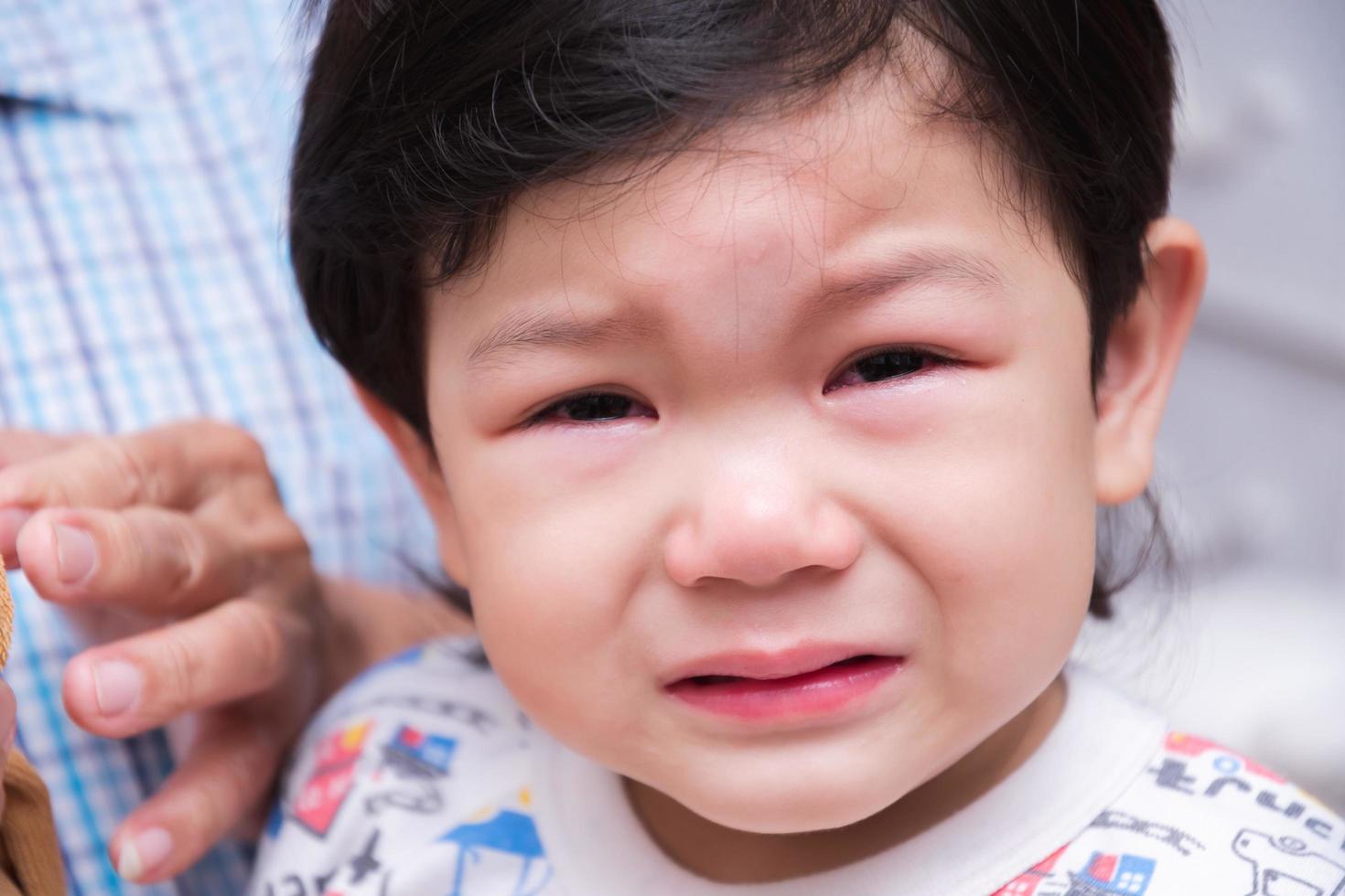 Boy face was crying from pain in forehead from impact. Bulging head child. photo