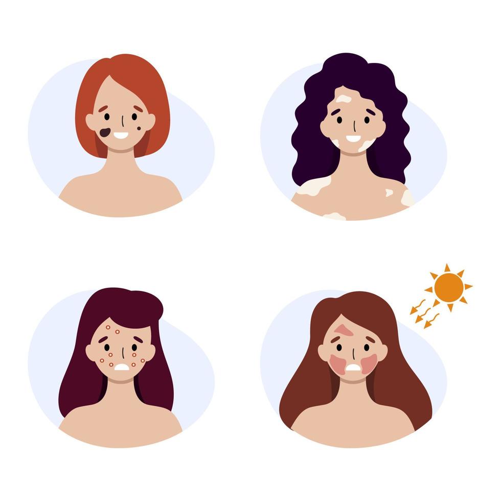 Women with various skin diseases. Sunburn and allergy symptoms on the face. vector