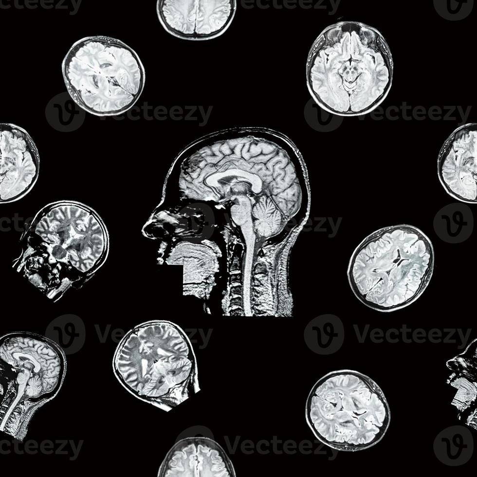 MRI of the head on a black background. Seamless pattern. The concept of timely detection of diseases of the head. Mental health. photo