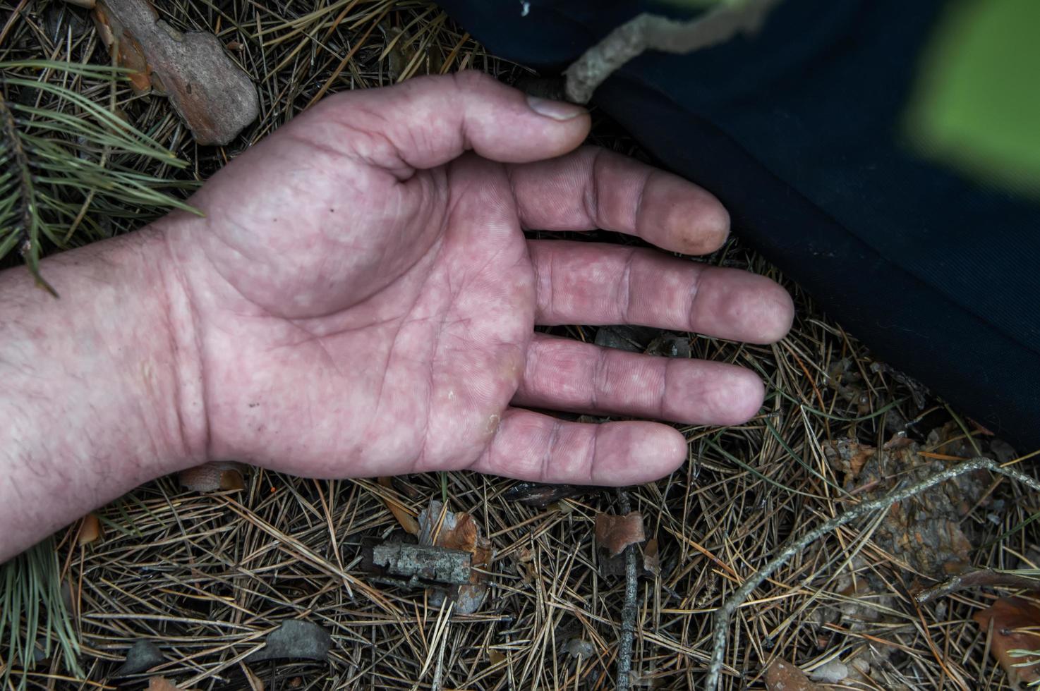 Murder in the woods. The hand of a dead man in the forest needles. Violent attack. Victim of crime. photo