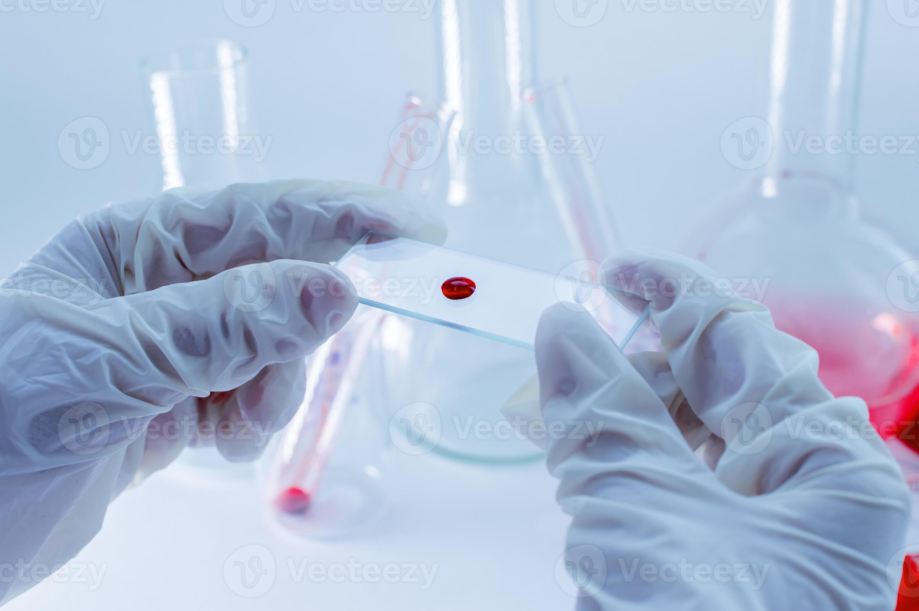 Medical laboratory. A glass plate with blood in the hand in a medical