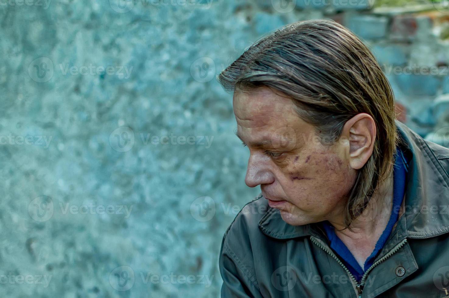 un vagabundo con un hematoma en la mejilla sentado en las ruinas. pobreza. hambre. foto