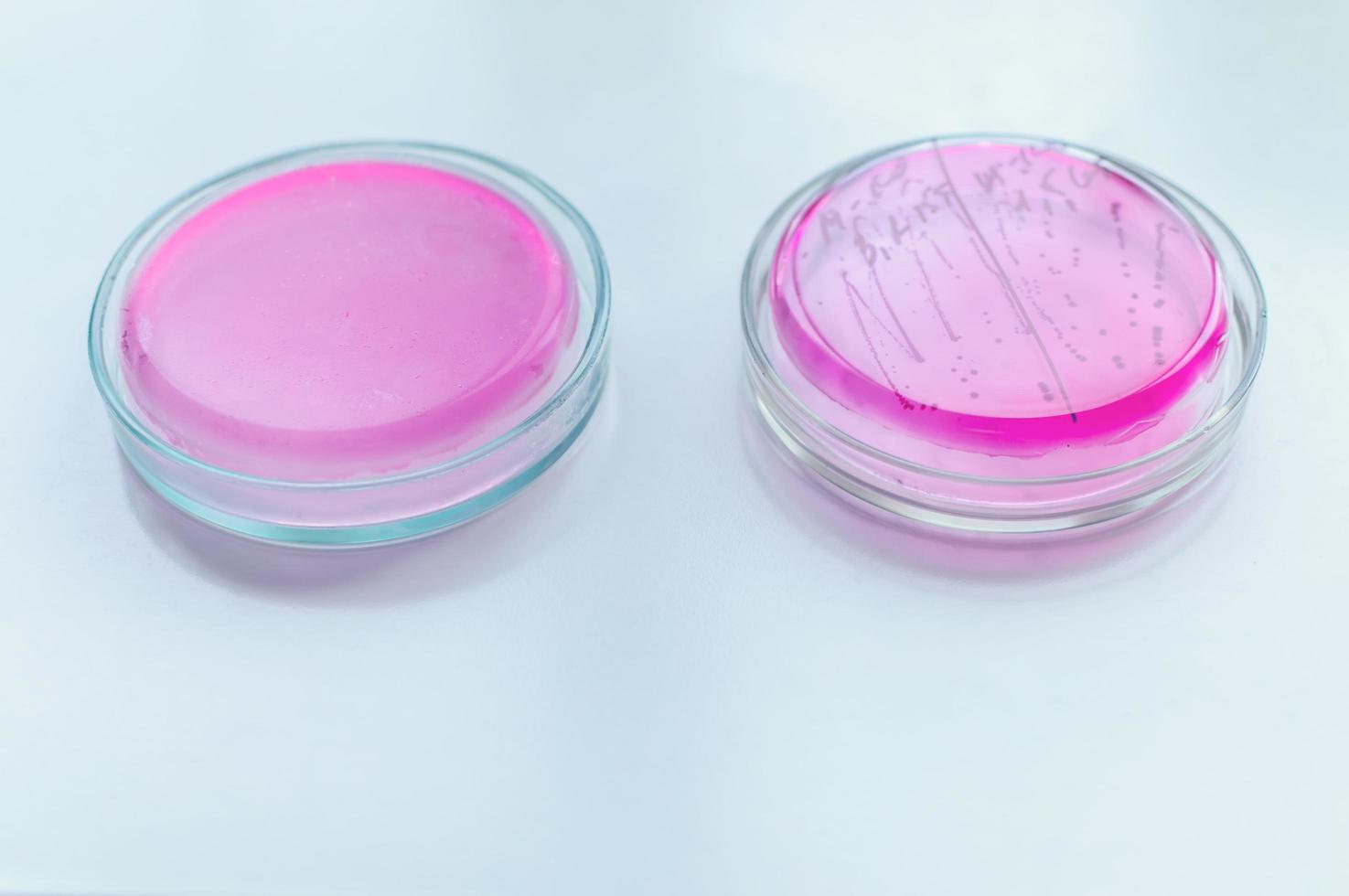 petri dish in the laboratory photo