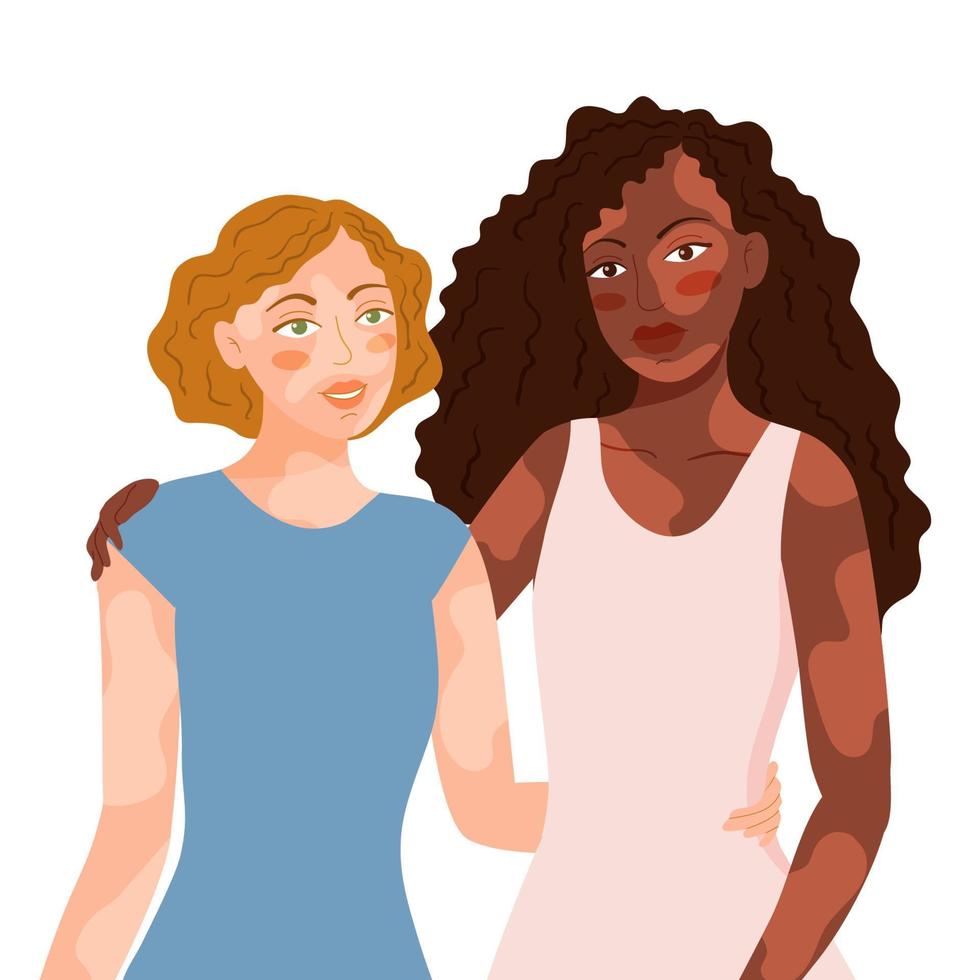 Two smiling girl with vitiligo dermatology disease skin problem of different nationalities standing together. World vitiligo day. Accepting oneself. Self care and self love. Flat vector illustration