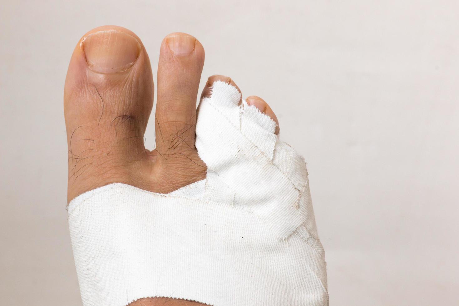 Close up of a Persons Bandaged up Broken Two Little Toes photo