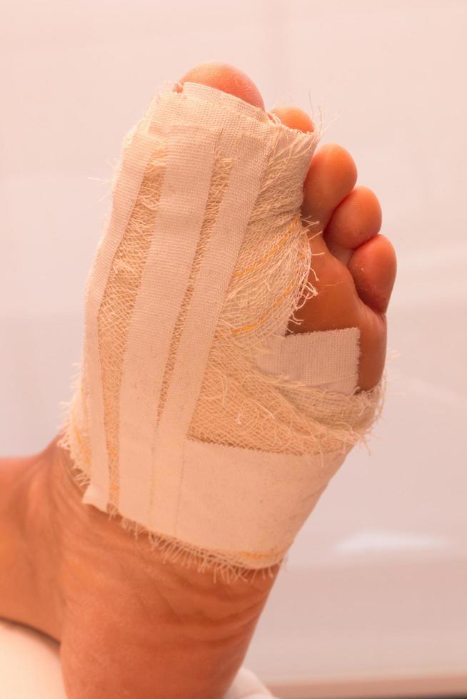 Close up of a Persons Bandaged up Broken Big Toe photo