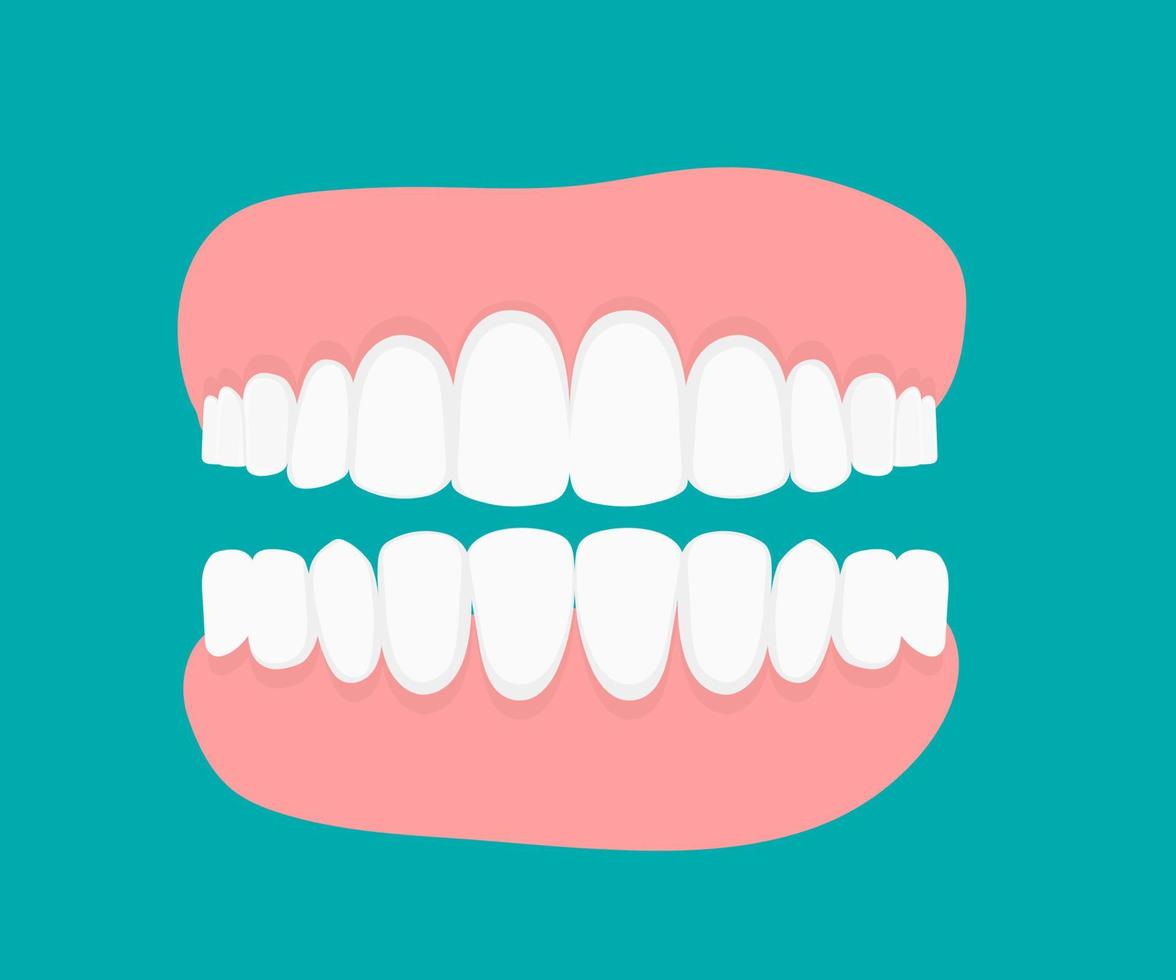 dientes con dentadura en diseño plano. concepto de vector plano. clínica dental, estomatología, enfermedad de ortodoncia, ilustración del problema. tratamiento de la enfermedad de los dientes, higiene bucal