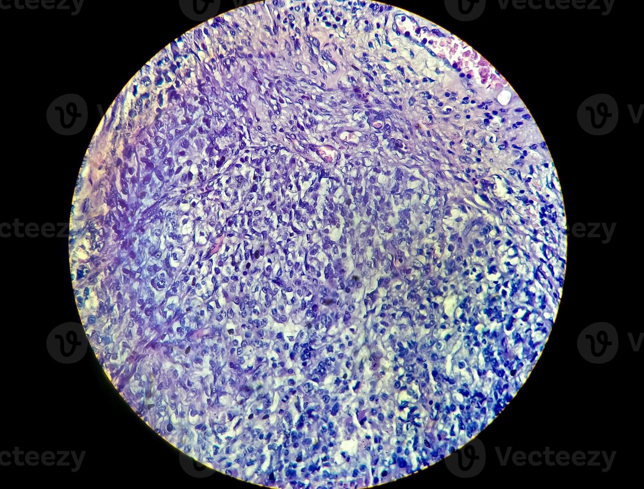 Antimicrobial susceptibility testing in petri dish. Antibiotic resistance test of bacteria photo