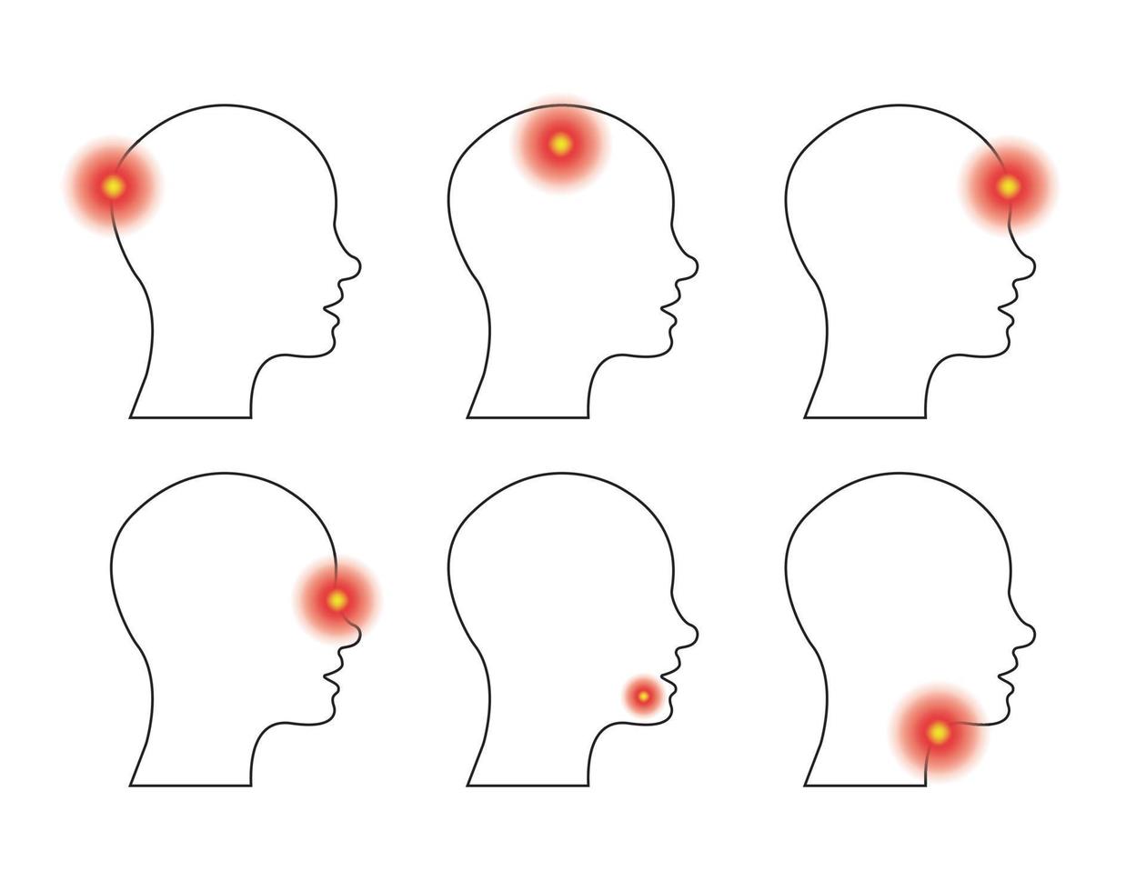 Type of headache and toothache, sore throat. Set of head profile with different pains. Side view. Vector